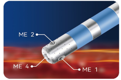 一次性使用磁定位微电极射频消融导管